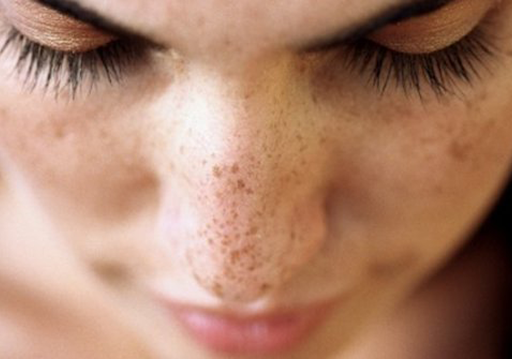 Éliminer les taches brunes sur le visage