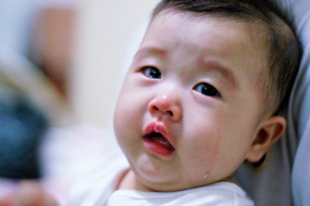 Le miel chez le bébé moins d'un an