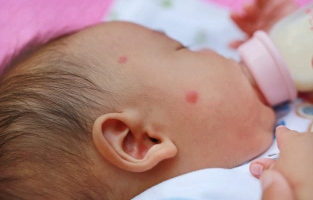 Comment Proteger Bebe Des Moustiques Comment Proteger Bebe Des Moustiques