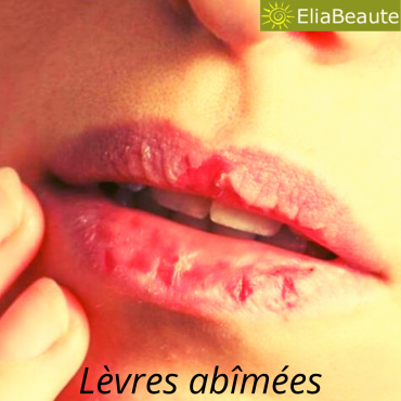 Comment avoir des lèvres roses naturellement