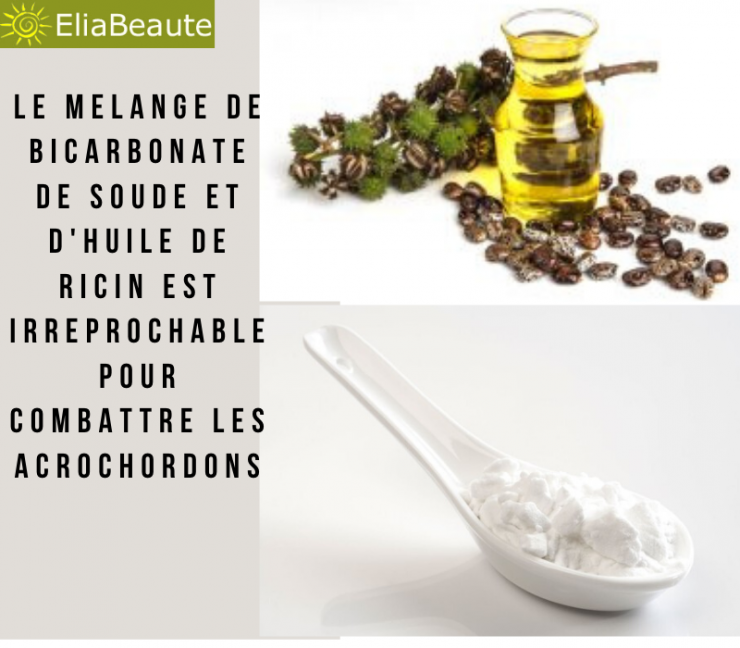 Acrochordons remèdes naturels pour les éliminer et prévention — free download