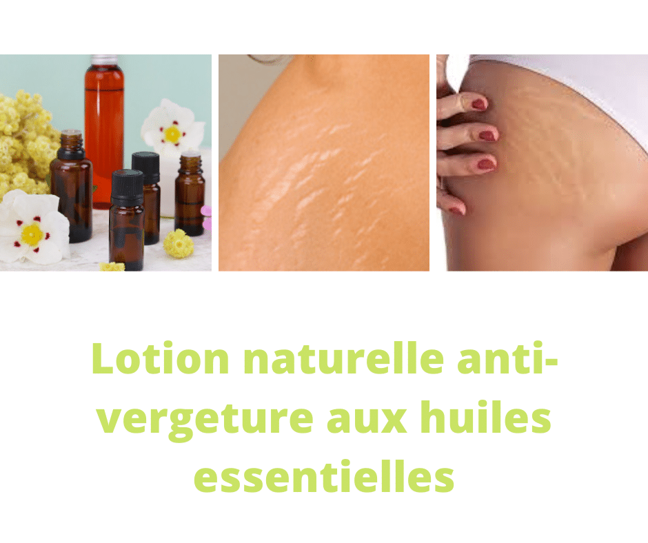 Huile de Soin Régénérante Naturelle Anti Vergetures et Cicatrices