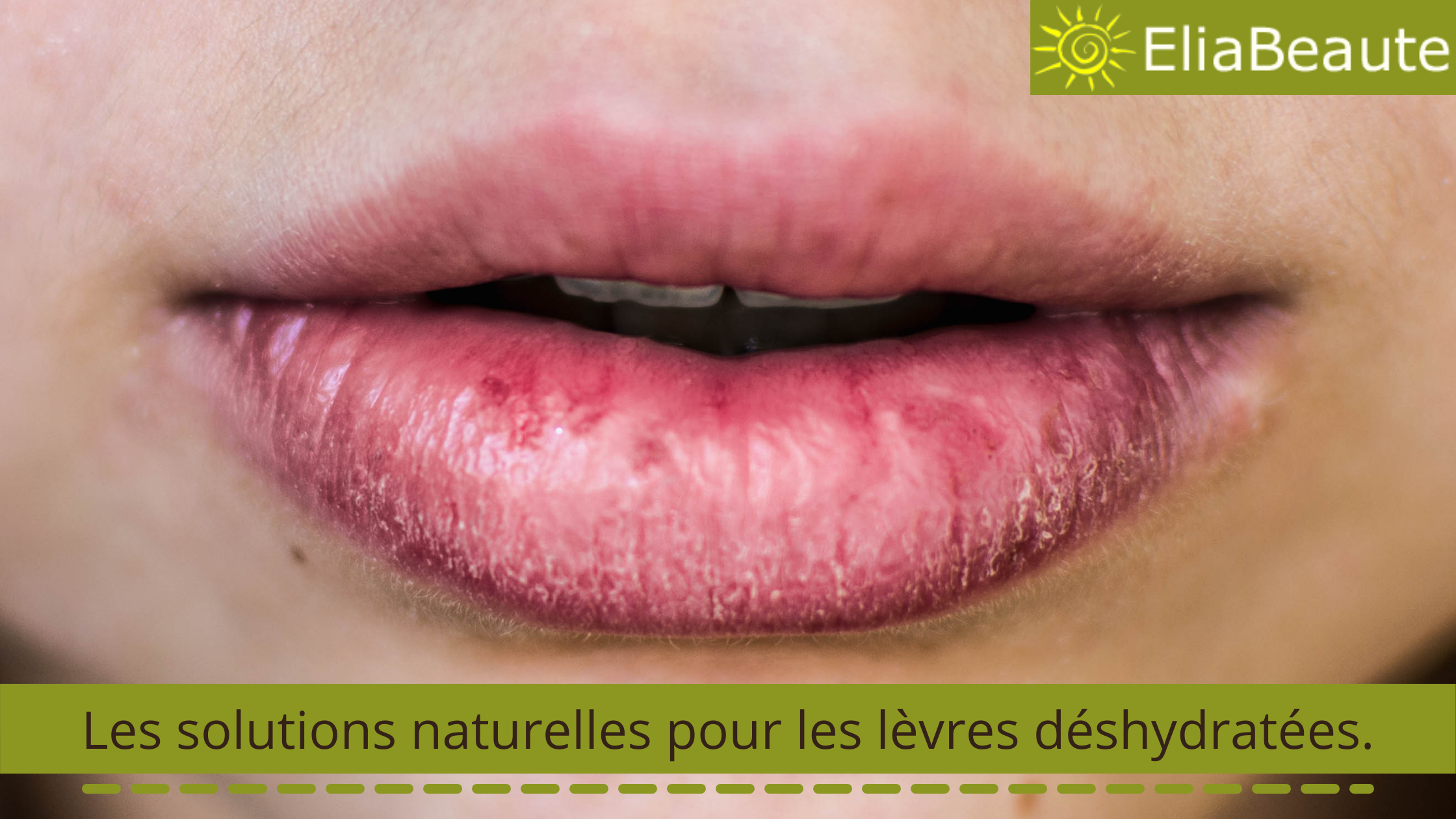Soigner les lèvres sèches